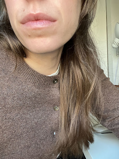 The writer's lips several after several hours of wearing the lip oil.