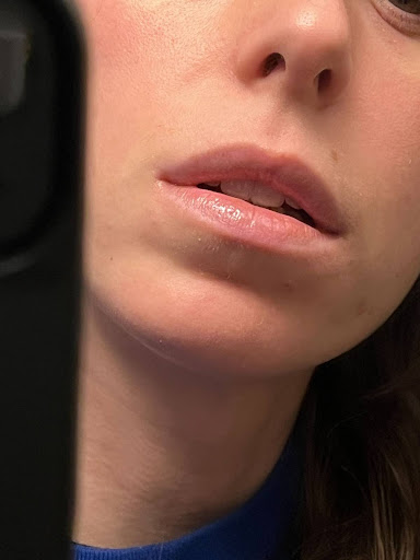 A close up of the writer's lips shortly after applying the lip oil.
